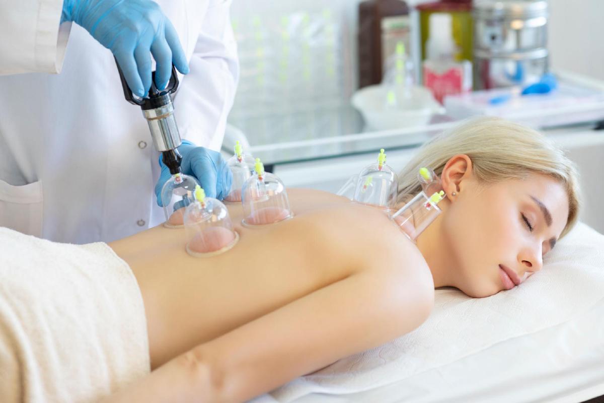Cupping Benefits